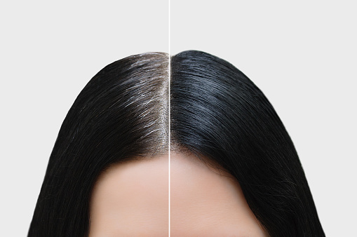 Cabeza de una chica de canas negras. Coloración para el cabello. Antes y después. Primer plano. photo