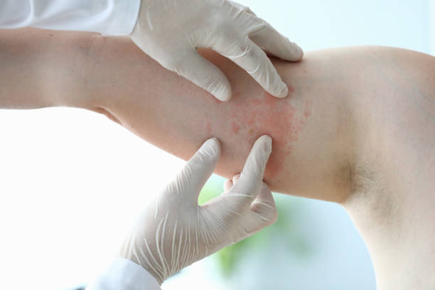 istock Male doctor in white protective gloves examing patient 1177335039