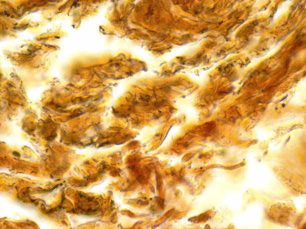 Microscopic Syphilis Sample 120+ Syphilis Microscope Stock Photos, Pictures & Royalty-Free Images ...