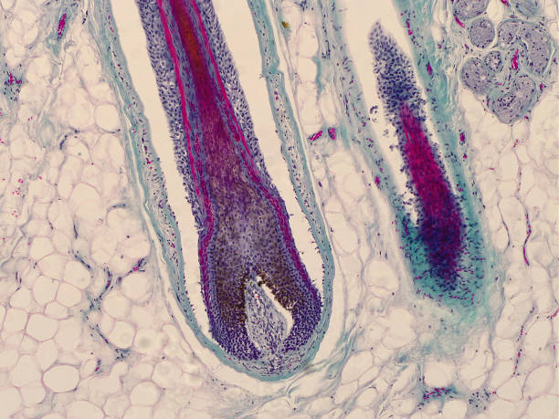 menschliche kopfhaut mit haarwurzel unter dem mikroskop. - histology stock-fotos und bilder