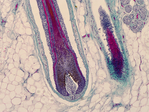 Microscopic picture (400x magnification) of roots of hair in human head skin. Hair follicles.