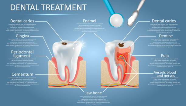 ilustraciones, imágenes clip art, dibujos animados e iconos de stock de diagrama vectorial de tratamiento dental educación medicina cartel infografías - conducto partes del cuerpo