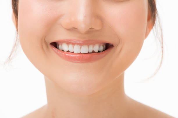 Human teeth