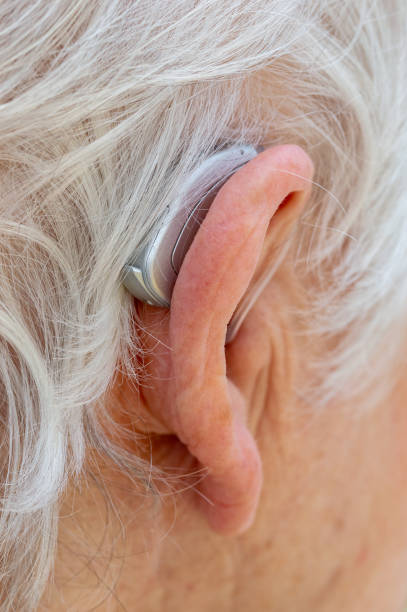 istock Behind The Ear hearing aid being worn by pensioner. 1177422905