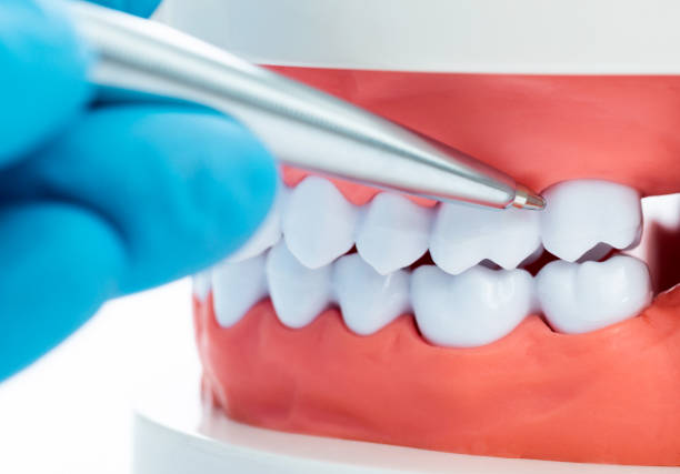 istock Dentist holding pen pointing to the dentures 1177667804