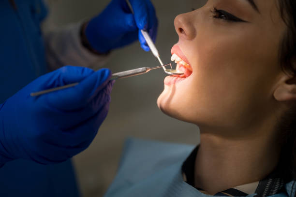 en los dentistas - mouth open dental drill holding doctor fotografías e imágenes de stock