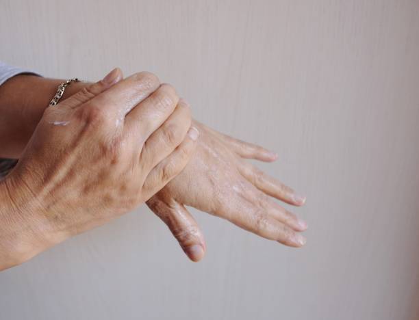 istock woman spreads the cream on her hands 1177860569