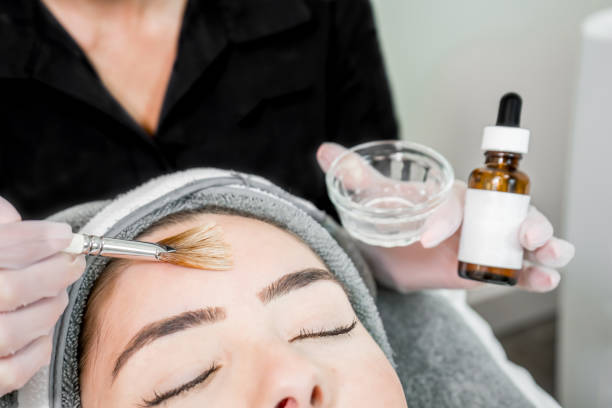 fermez-vous vers le haut de l'esthéticienne (cosmétologue) appliquant le traitement chimique de peau sur le patient dans un spa de beauté, pour le rajeunissement de peau, le teint et les traitements de beauté d'acné. - peeling beauty treatment human face beautician photos et images de collection