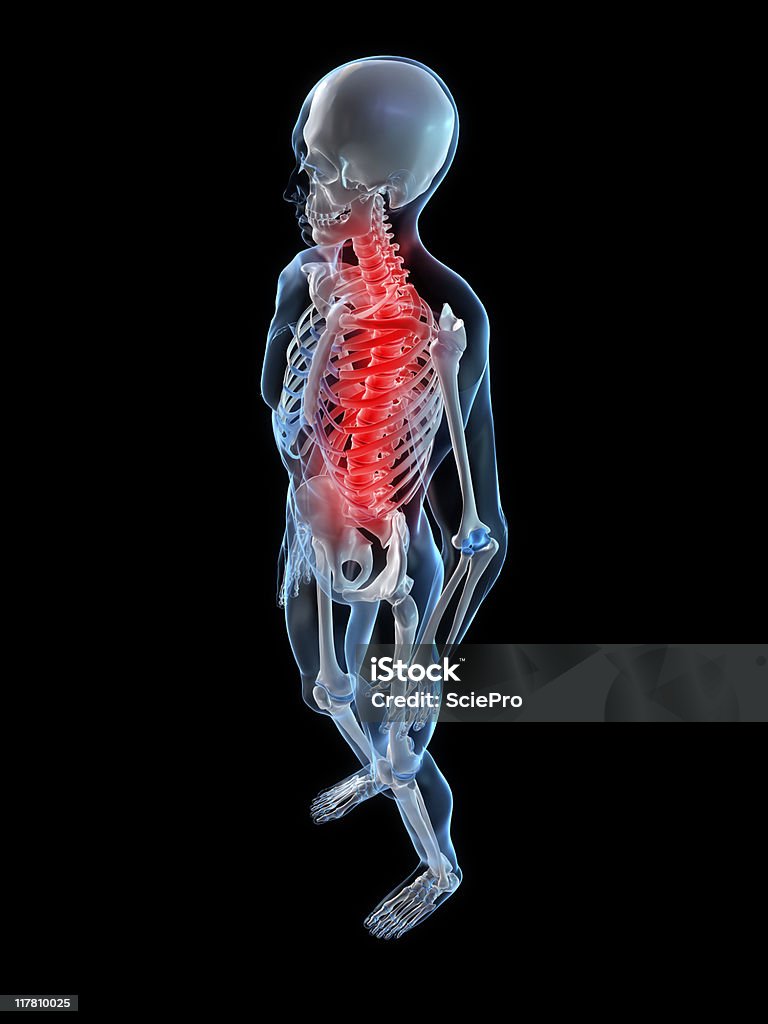 Ilustración de espalda - Foto de stock de Anatomía libre de derechos