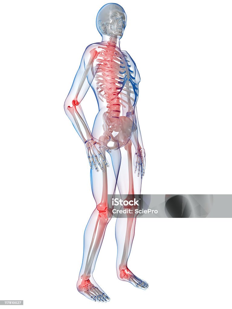3D graphic of human anatomy featuring painful joints painful joints Anatomy Stock Photo
