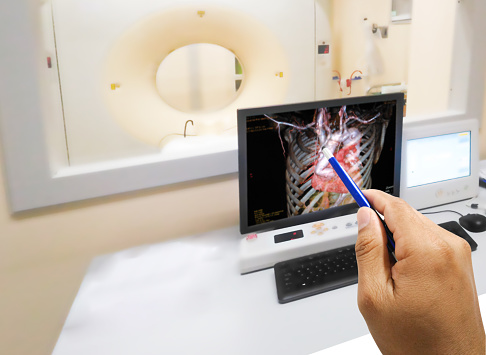 Hand holding a pen point Computed Tomography Angiography Coronay (CTA coronary) with blur background.