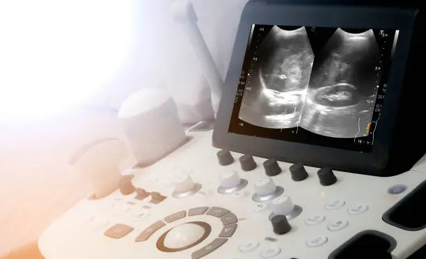 Photo of a medical equipment background, close-up ultrasound machine