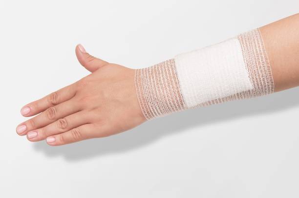 bandage on injured human arm - gauze imagens e fotografias de stock