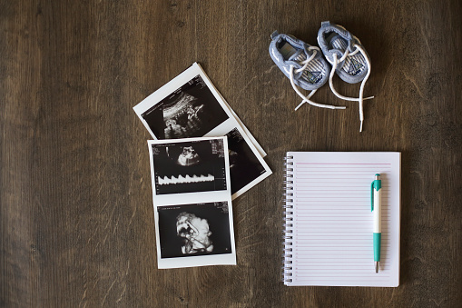 Note pad, pencil, ultraasound images and baby shoes on a table.