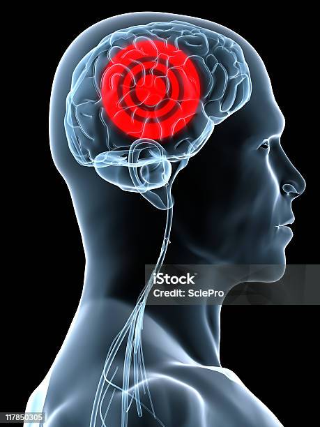 Headache Stock Photo - Download Image Now - Anatomy, Biology, Cerebellum