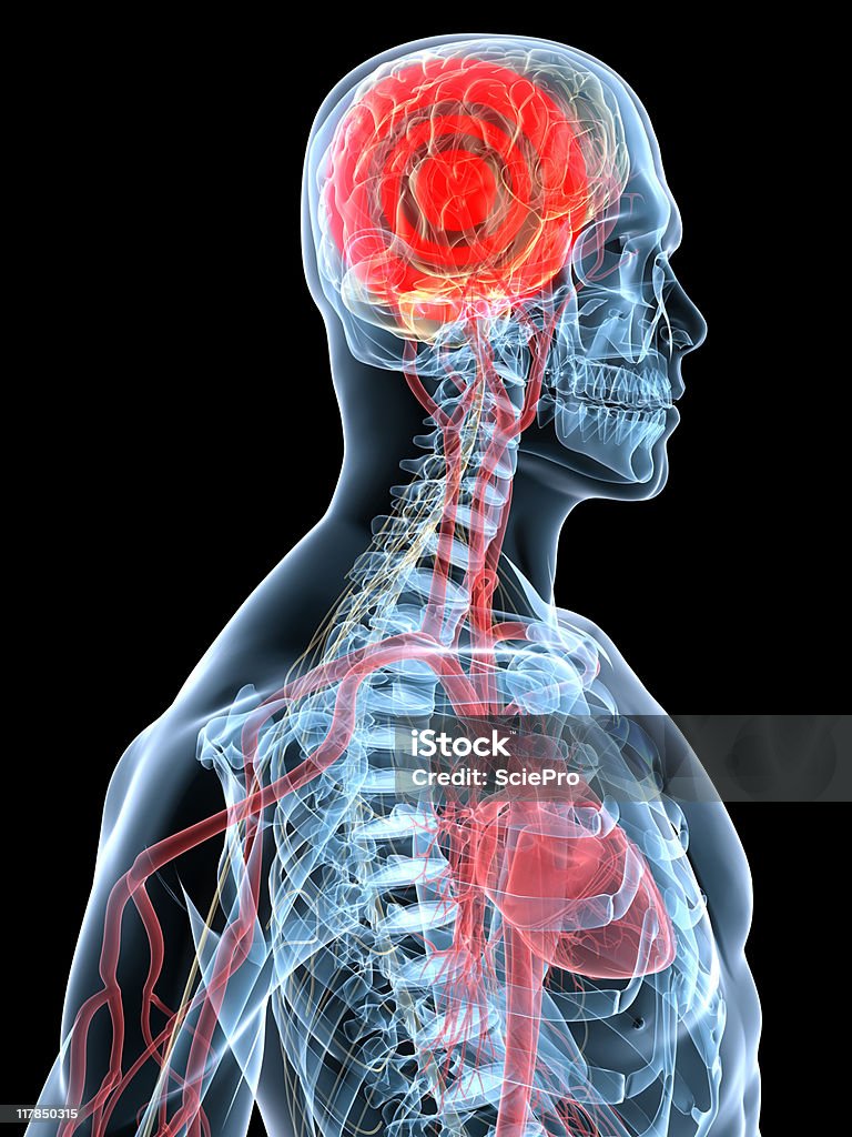 headache headache illustration Anatomy Stock Photo