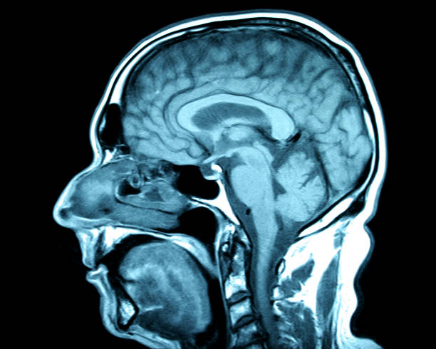 istock Magnetic Resonance Imaging MRI of Brain 1178580968