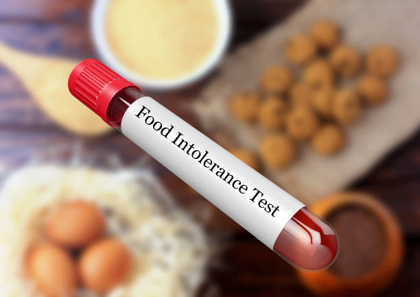 Blood sample in test tube for food intolerance test in laboratory Blood sample in test tube for food intolerance test in laboratory. 3D rendering food allergies stock pictures, royalty-free photos & images