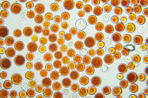 Haematocysts of single-celled green algae, 