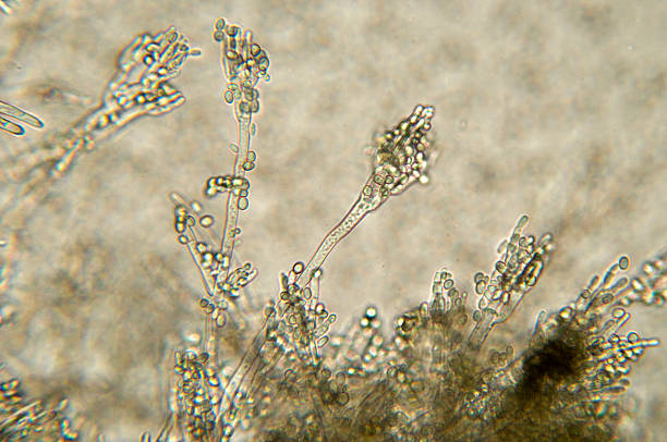 penicillium schimmel aufnahme - wissenschaftliche mikroskopische aufnahme stock-fotos und bilder
