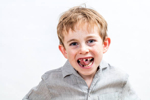 cute giggling boy with freckles being annoyed by his tooth missing, isolated, white background