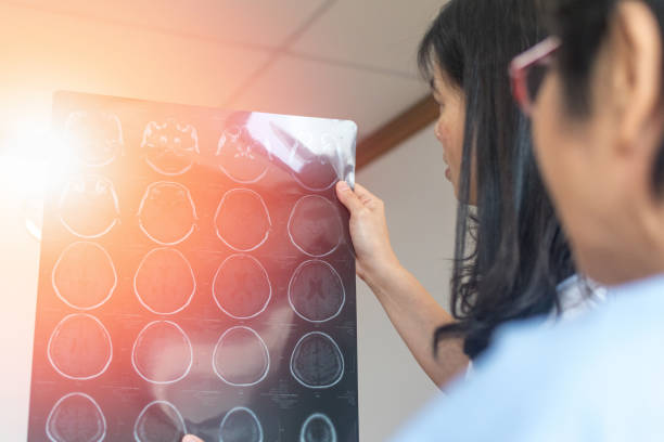 il medico neurologo o il radiologo mostrano la risonanza magnetica a raggi x del cervello per consultare la pazienza dell'ictus in ospedale - mri scanner cat scan x ray medical scan foto e immagini stock