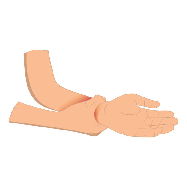 illustrazioni stock, clip art, cartoni animati e icone di tendenza di dolore al polso, uomo che tiene il dolore al polso perch