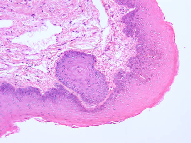 istock histology of human tissue 1178971207