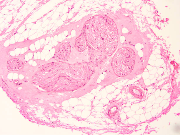 istock histology of human tissue 1178971219