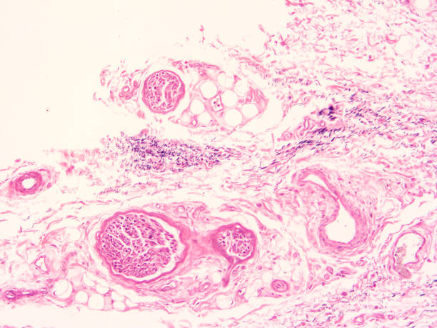 istock histology of human tissue 1178972501