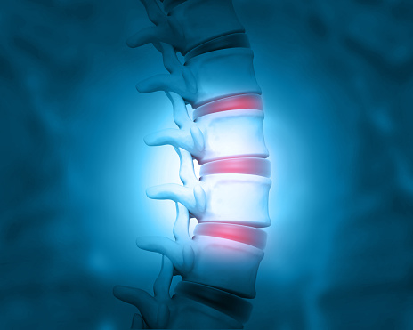 Disc problem of human spine. 3d illustration