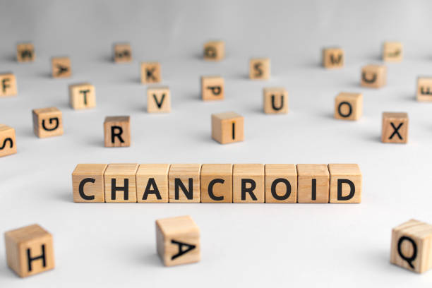 istock Chancroid - word from wooden blocks with letters 1179171406