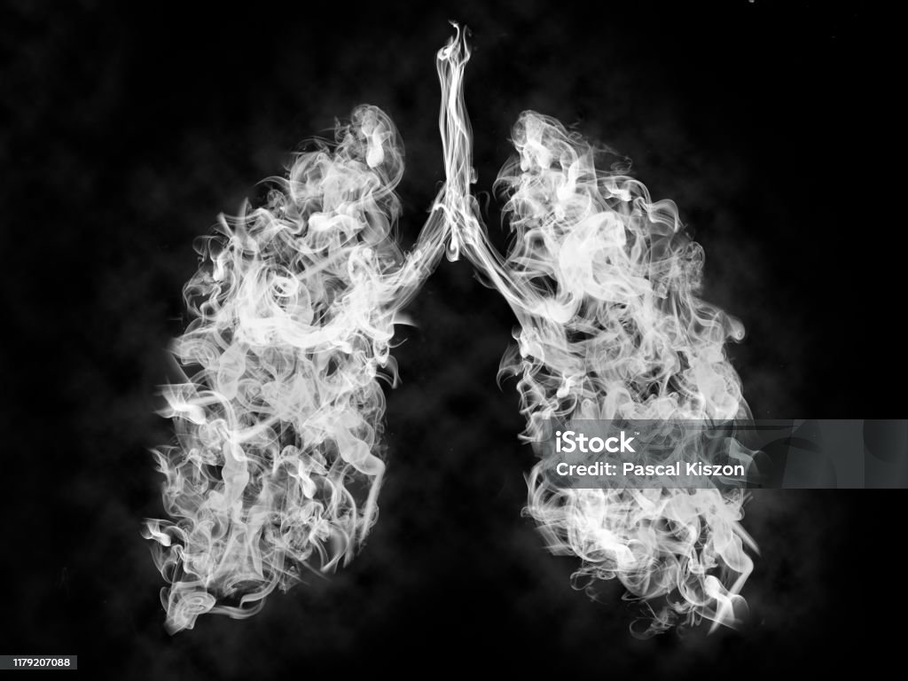 肺の有毒煙のイラスト.がんまたは病気の概念 - タバコを吸うのロイヤリティフリーストックフォト
