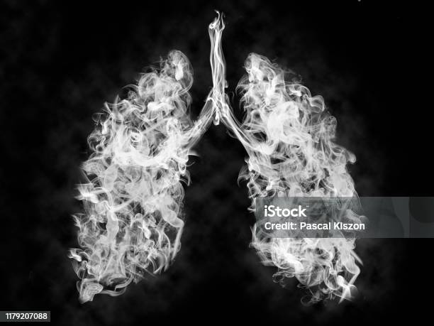 肺の有毒煙のイラストがんまたは病気の概念 - タバコを吸うのストックフォトや画像を多数ご用意 - タバコを吸う, 肺, 煙