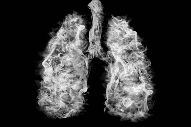 肺の有毒煙のイラスト.がんまたは病気の概念 - anti smoking ストックフォトと画像