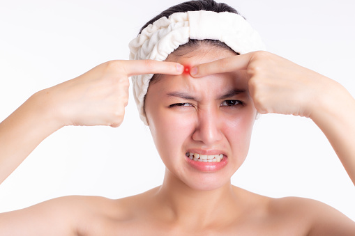 Người Phụ Nữ Châu Á Bị Viêm Mụn Nổi Mụn Trên Trán Khuôn Mặt Xinh Đẹp Cô Gái Xinh Đẹp Bị Tổn Thương Không Hạnh Phúc Mụn Trứng Cá Xảy Ra Do Căng Thẳng Trong Công Việc Hoặc Khi Phụ Nữ Có Đư Hình ảnh Sẵn có - Tải xuống Hình ảnh Ngay ...