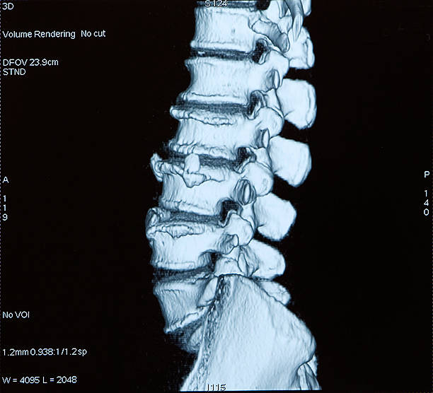computergesteuertes tomography - human vertebra fotos stock-fotos und bilder