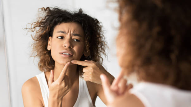 istock Afro Girl Squeezing Pimple Looking In Mirror In Bathroom, Panorama 1179532735