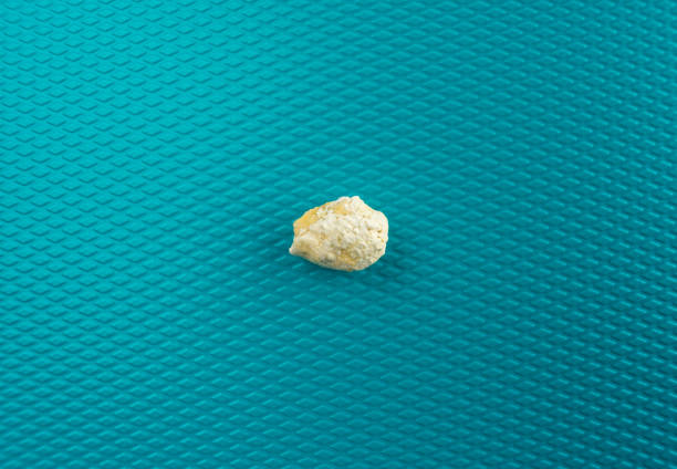 piedra de conducto salival de sialolithiasis - salivary gland fotografías e imágenes de stock