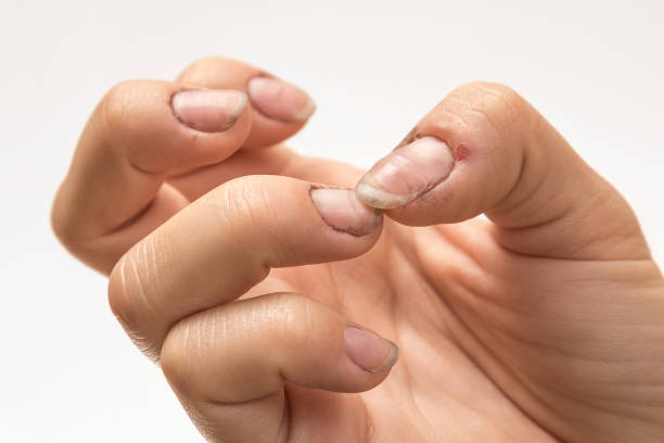 汚れた爪を持つ女性の手 - homelessness human hand dirty unhygienic ストックフォトと画像