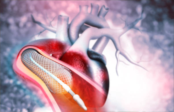 istock Human heart angioplasty 1179936858