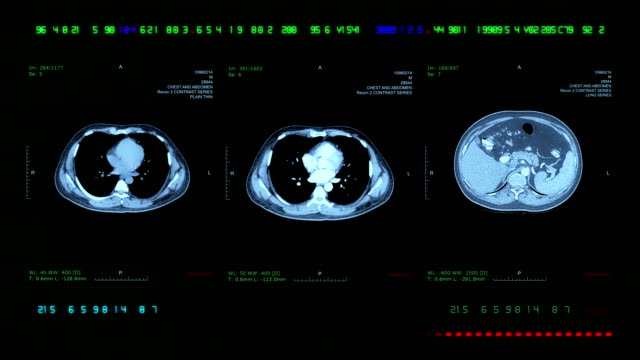 Chest and Abdominal MRI Scan