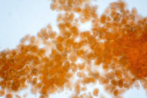 Adipose tissue under the microscope view show contains large lipid droplet.