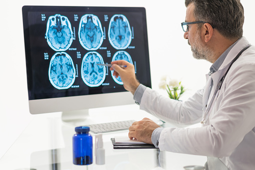 Hombres médico examinando la RMN cerebral photo