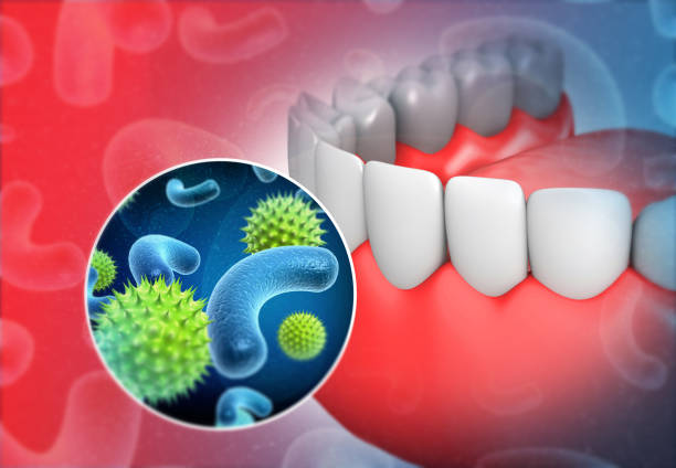 29,773 Mouth Bacteria Stock Photos, Pictures & Royalty-Free Images - iStock  | Toothbrush, Teeth, Plaque