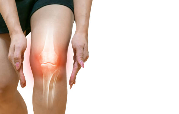 infiammazione dell'osteoartrite della gamba umana delle articolazioni ossee - ligament foto e immagini stock