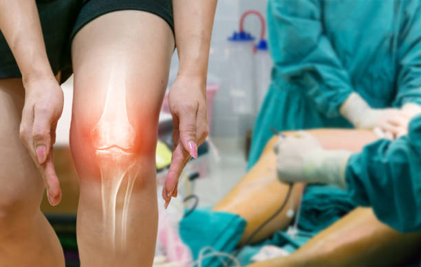 istock Human leg Osteoarthritis inflammation Of bone joints 1180607423