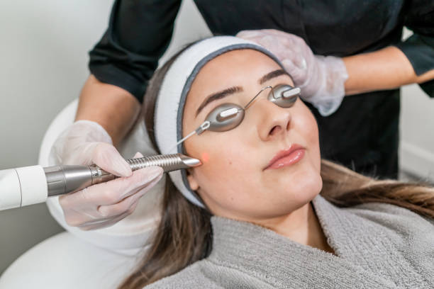 100+ Yag Laser Stock Photos, Pictures & Royalty-Free Images - iStock