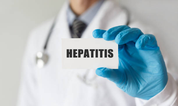 Doctor holding a card with text HEPATITIS, medical concept Doctor holding a card with text HEPATITIS, medical concept hepatitis photos stock pictures, royalty-free photos & images
