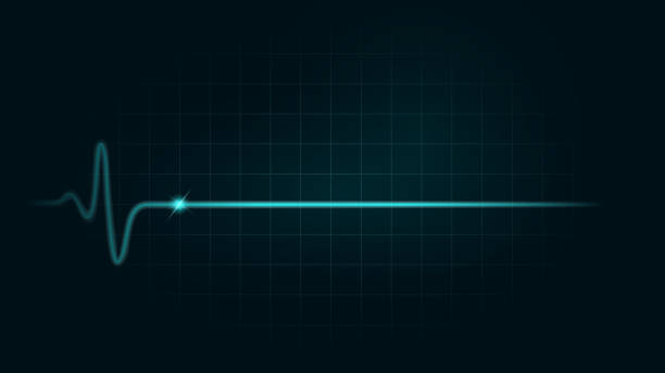 istock Pulse rate Line while dead on green chart background of monitor. Illustration about heart failure. 1180824246